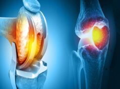 Early Signs of Bone Marrow Cancer You Should Know